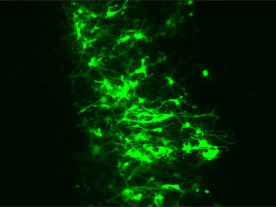 Rat Brain Slices4